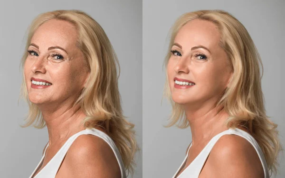 Toxins Botox and Jeuveau Small.1jpg